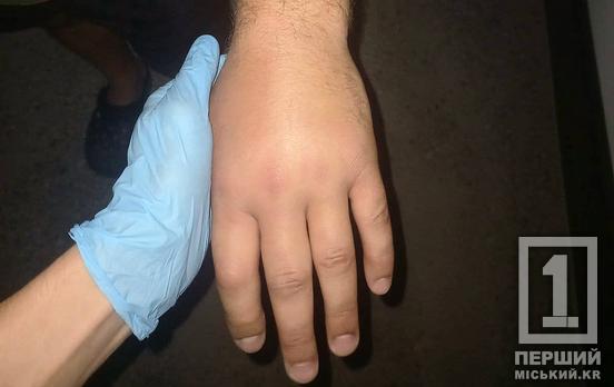 У Дніпропетровській області на чоловіка напала гадюка під час відпочинку