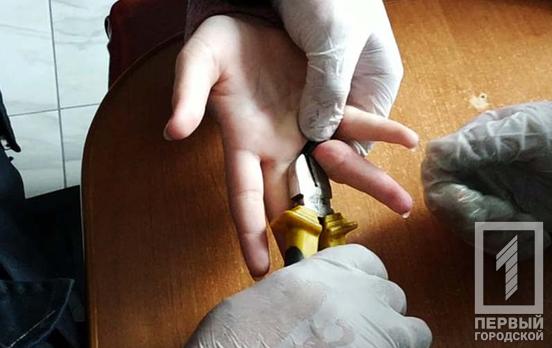 В Кривом Роге спасатели болгаркой разрезали кольцо, застрявшее на пальце девочки