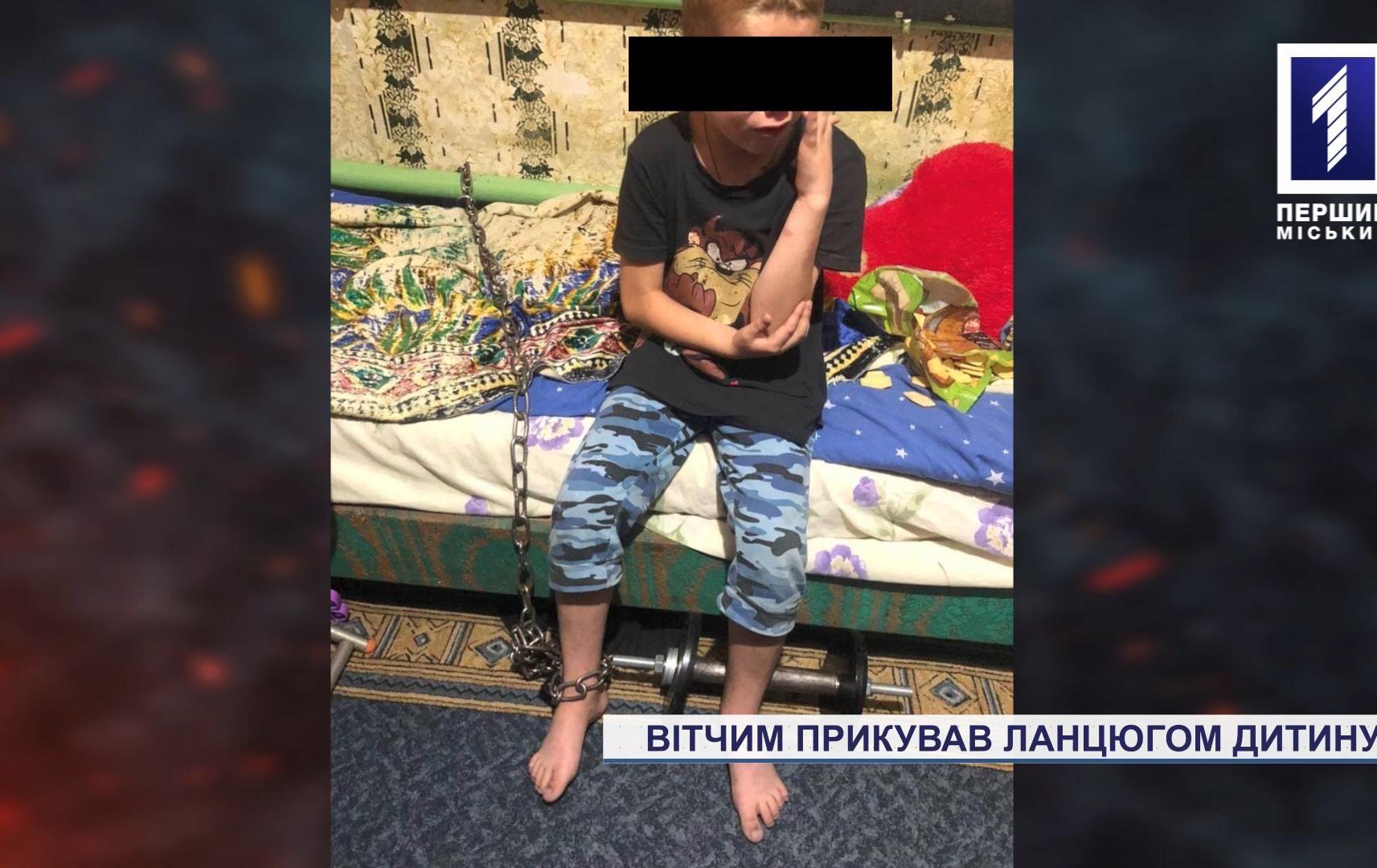 Новини Кривого Рогу: вітчим прикував ланцюгом 7-річну дитину