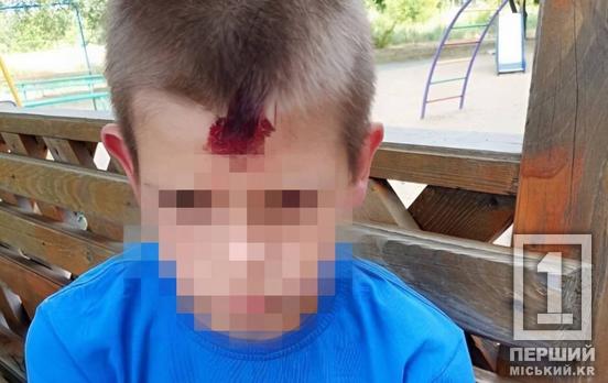 У Кривому Розі через стрілянину травмовано дитину