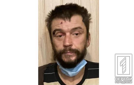 Полиция Кривого Рога разыскивает 42-летнего вероятного грабителя