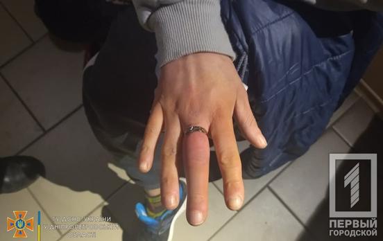 В Кривом Роге спасатели помогли снять кольцо с пальца женщины