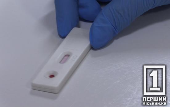 Безкоштовне тестування на ВІЛ, гепатит, туберкульоз та ІПСШ: Україна долучається до Європейського тижня тестування