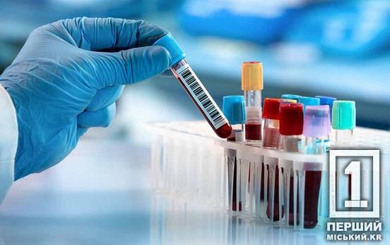 Безкоштовно та анонімно: мешканців Кривого Рогу запрошують на тестування, яке рятує життя