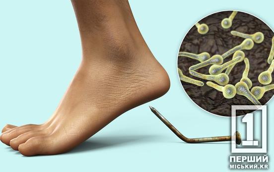 Болючі спазми та навіть переломи кісток: що відомо про правець і скільки випадків зафіксували у Дніпропетровській області