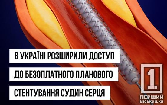Безоплатна допомога для «сердечників»: громадяни можуть отримати стент за програмою медичних гарантій