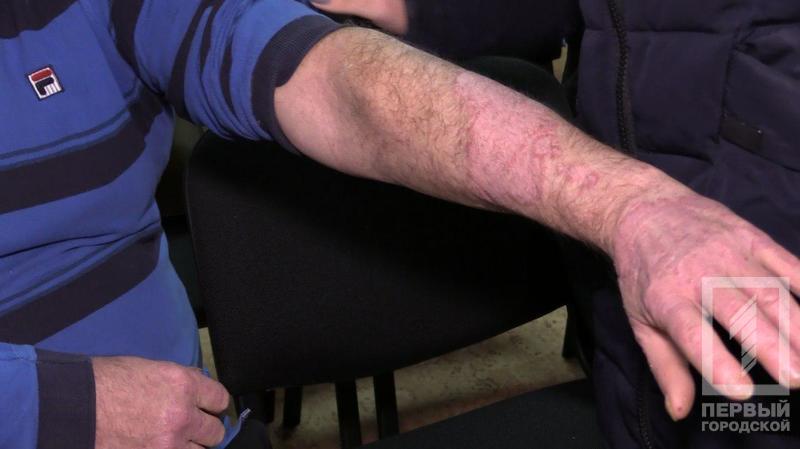 %d0%bf%d1%81%d0%be%d1%80%d0%b8%d0%b0%d0%b7 %d1%80%d1%83%d0%ba%d0%b02