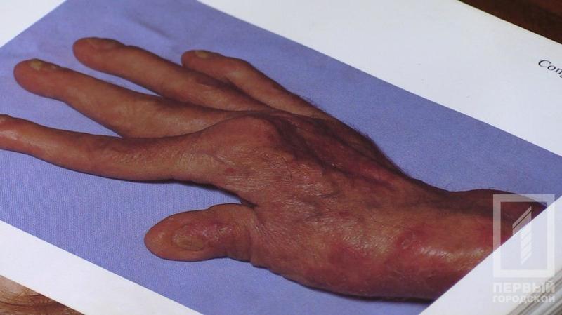 %d0%bf%d1%81%d0%be%d1%80%d0%b8%d0%b0%d0%b7 %d1%80%d1%83%d0%ba%d0%b01