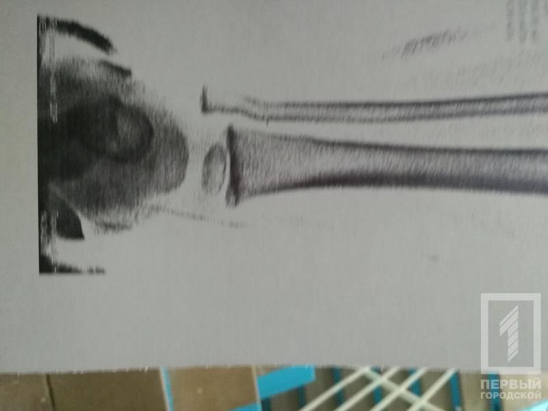 %d0%b3%d0%b8%d0%bf%d1%81 %d0%bf%d0%b5%d1%80%d0%b5%d0%bb%d0%be%d0%bc